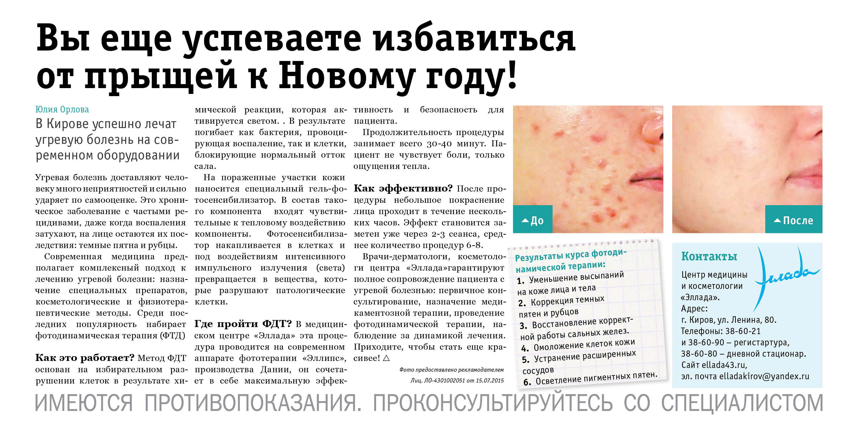 Как избавиться от прыщей к Новому году?